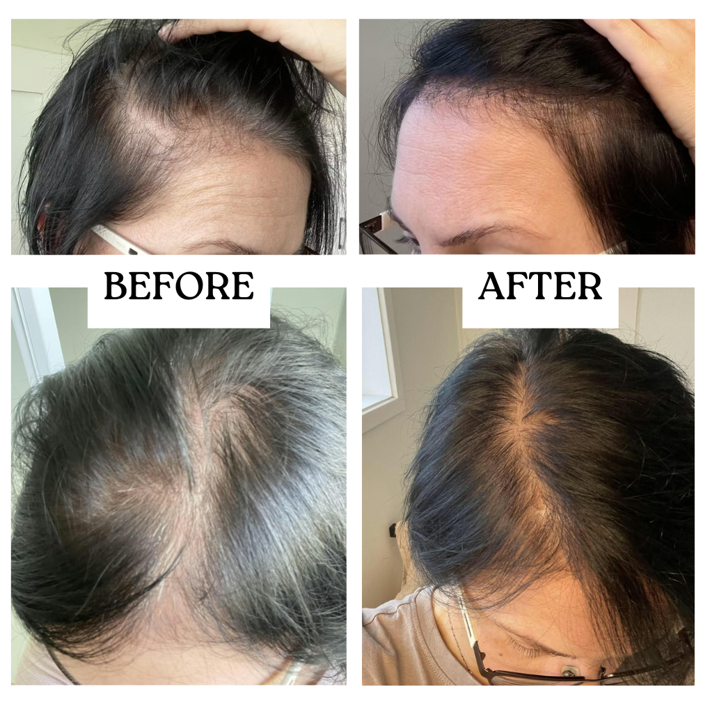 Before and after comparison of hair condition on a person's head.
