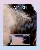 Hair Growth Activator