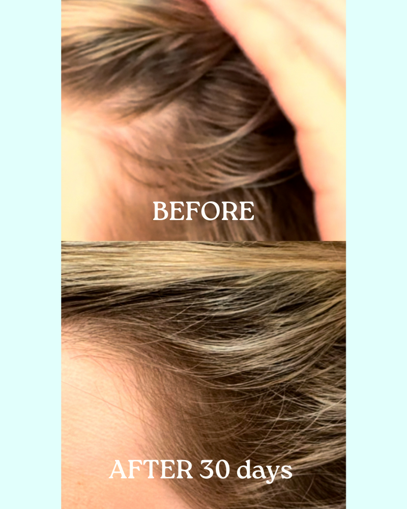 Before and after comparison of hair growth with 'Before' showing thinning hair and 'After 30 days' showing thicker hair.