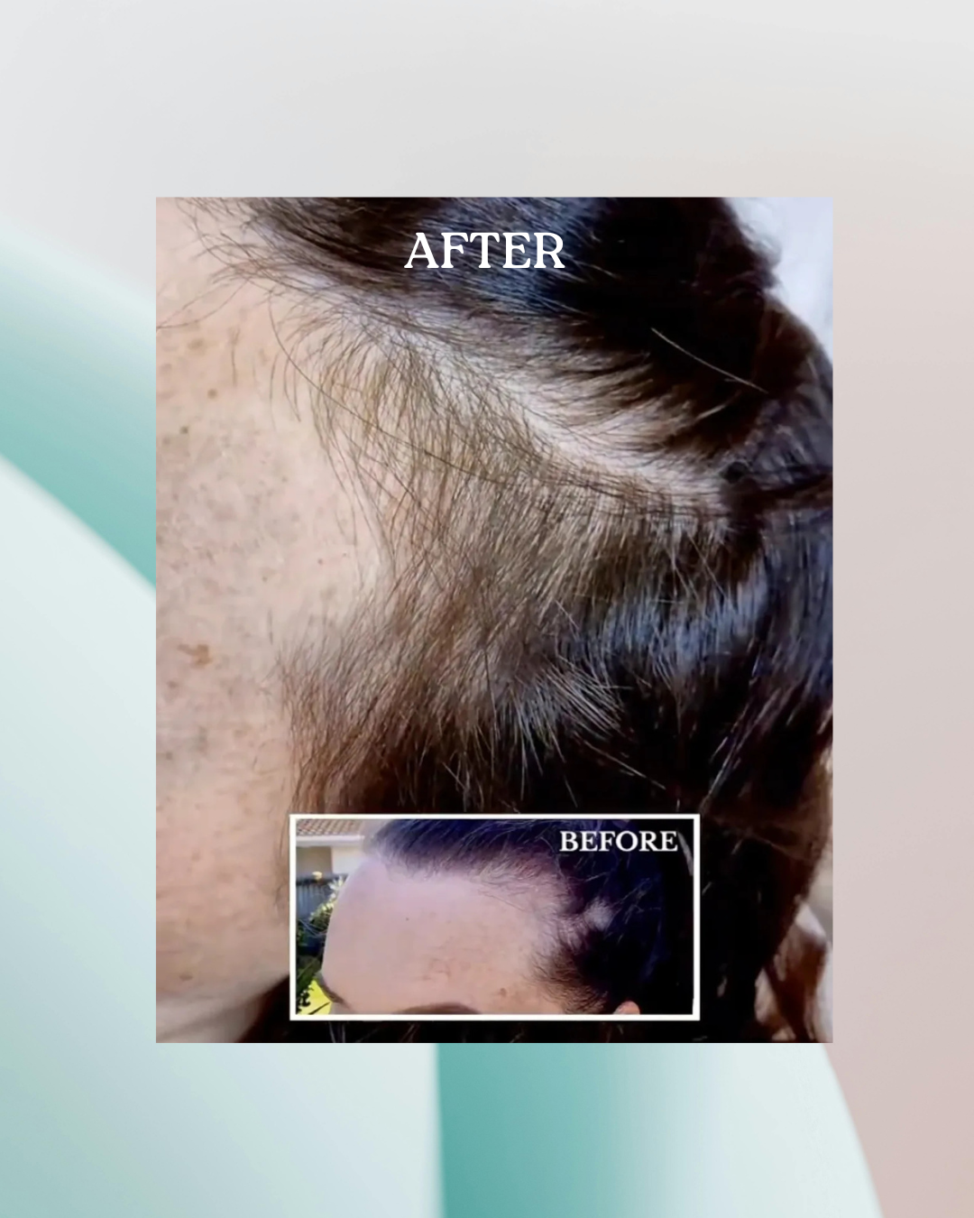 Hair Growth Activator + Scalp Tool Duo