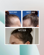 Before and after comparison of hair treatment on a person's head.