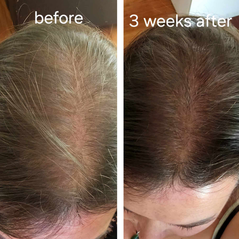 Before and after comparison of hair growth on a person's head.