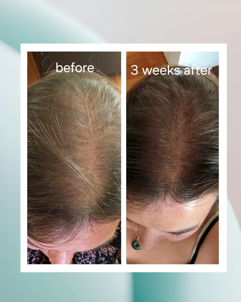 Hair Growth Activator