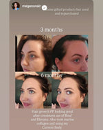 Before and after hair growth comparison over 3 months and 6 months with text overlay on a beige background.